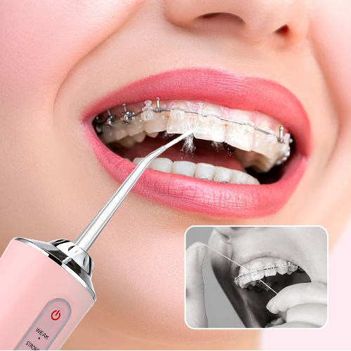 🦷 IRRIGADOR BUCAL POWER CLEAN + 4 BOQUILLAS GRATIS 🌟